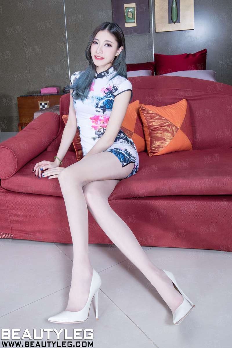 柏林综合症